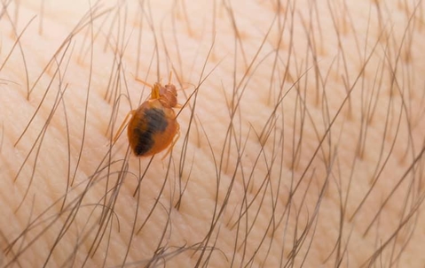Bed bug on skin