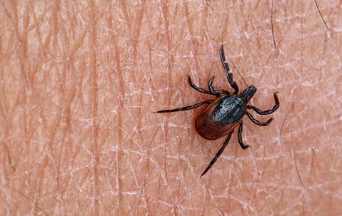 tick biting skin